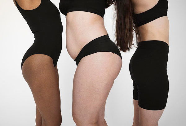 Terapia Descongestiva Completa (TDC) para Lipedema