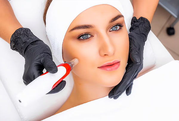 Rejuvenecimiento Facial Avanzado con Dermapen