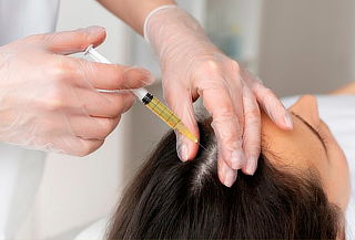 Regeneración Capilar Natural con Plasma Rico en Plaquetas