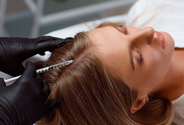 Mesoterapia y Examen Capilar a Domicilio 