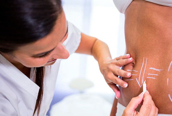 Reductor de Abdomen + Levantamiento Glúteos por 180 Sesiones