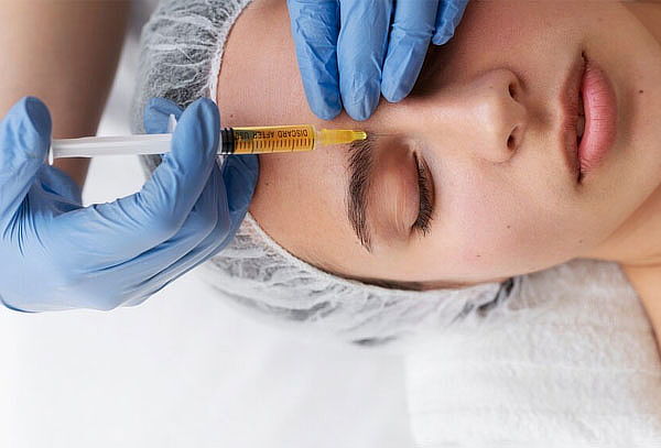 Plasma Gel para Surcos Nasogenianos y Entrecejo 