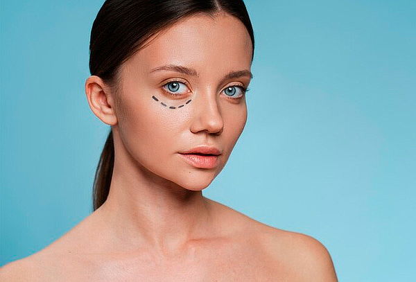 Despigmentación de Ojeras con Mesoterapia a Domicilio 