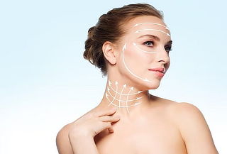 10 o 20 Hilos de Colágeno PDO lifting Facial o Corporal 