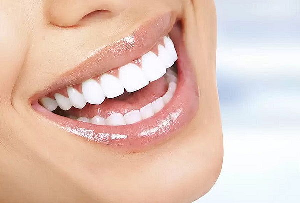 1 Sesión De Blanqueamiento + Valoración 