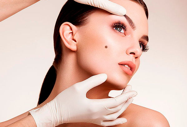 Remoción de Lunares o Verrugas con Láser CO2 en Chicó