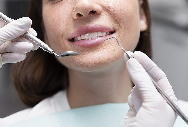 Limpieza Dental + Detartraje + Desmanchado + Profilaxis 