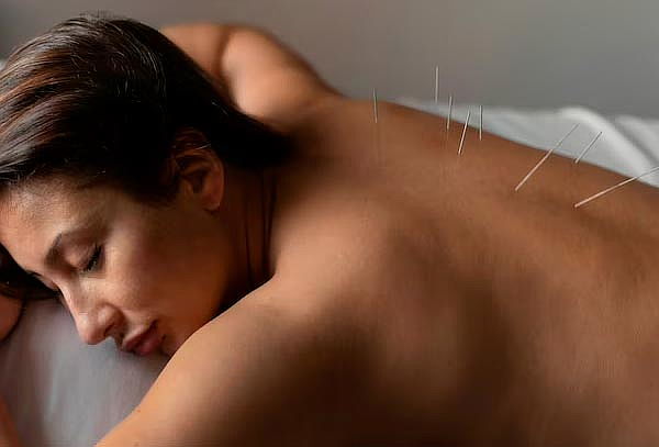 Valoración general + 1 sesión Acupuntura + Auriculoterapia