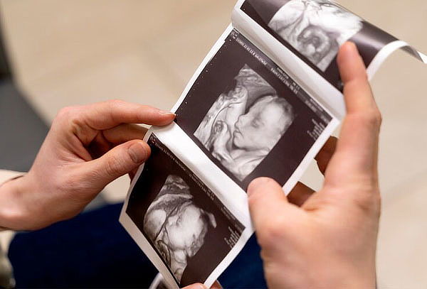 Ultrasonido Fetal Cromosómico + Diagnostico + 10 Fotografías