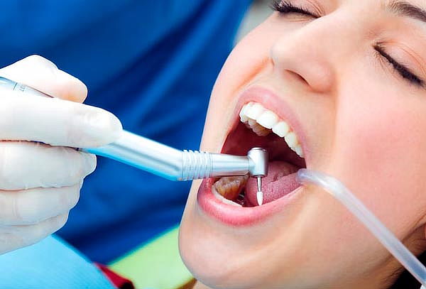 Consulta + Limpieza Dental 