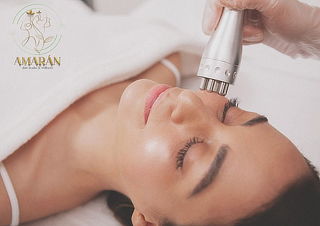 3 sesiones de Lifting facial 