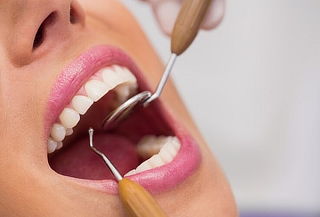 4 Resinas + Limpieza Dental con Ultrasonido + Consulta