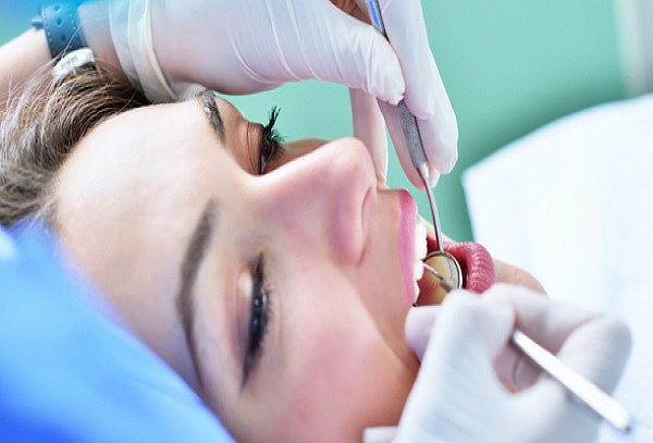 Consulta + Eliminación de caries + Limpieza Dental