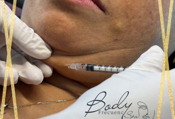 Mesoterapia + Vacumterapia + Bebida