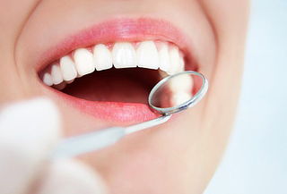 Blanqueamiento dental láser+limpieza con ultrasonido y más