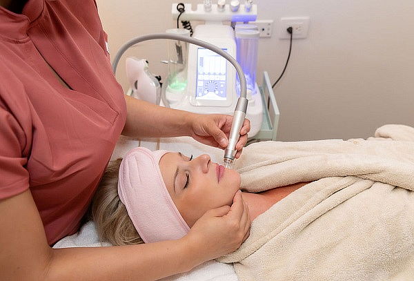 Microdermoabrasión exfoliación facial 