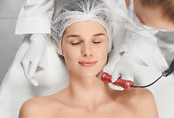 Radiofrecuencia Facial +Carboxiterapia Facial en Perfect 10 