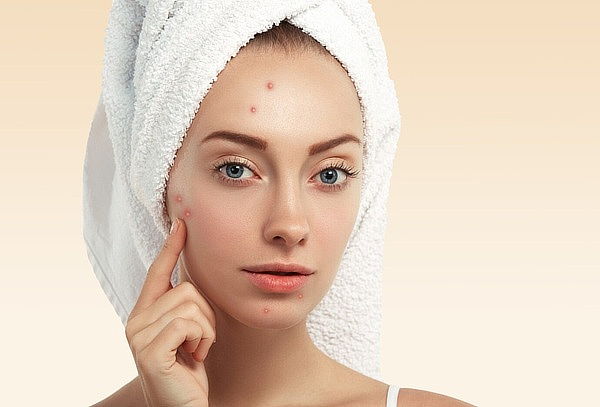 Peeling para Cicatrices de Acné y Manchas + Regalo