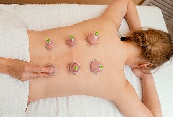 Masaje de espalda con ventosas