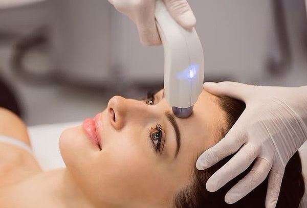 Radiofrecuencia facial reafirmante 