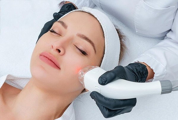 Radiofrecuencia Fraccionada + Limpieza Facial + Péptidos