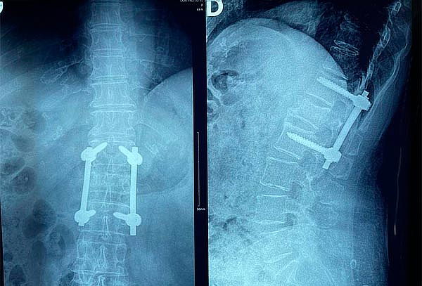 ¡Check Up Ortopédico c/opción a infiltración en H. Ángeles!