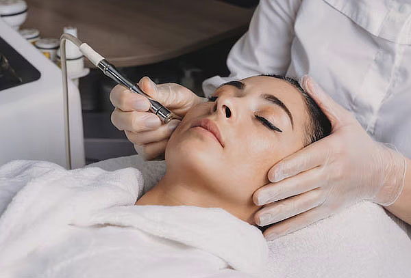 Limpieza Facial Profunda con Microdermoabrasión y más