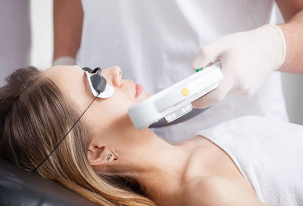 Despigmentación Rostro Completo con Laser 