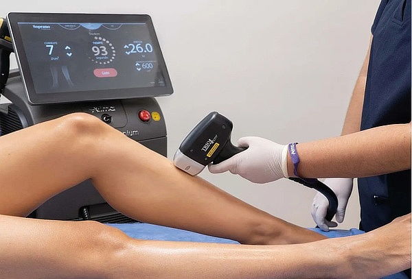 Depilacion Laser Soprano Axilas y Brazos ó Bikini y Piernas