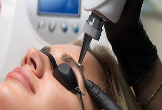Remoción de Microblading con Laser en Cejas
