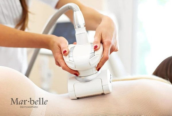 2 sesiones: Moldeo corporal + Drenaje + Radiofrecuencia