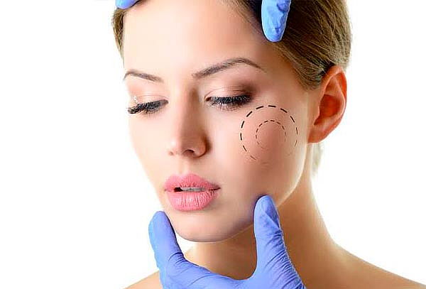 Retiro de Bolsas de Bichat ¡Hospital Mocel!