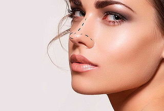 Levantamiento de punta nasal + aumento de labios 