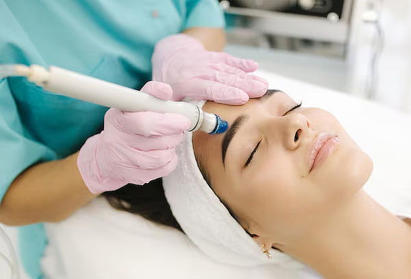 Facial Limpieza Profunda con Dermapen + Ácido Hialurónico 