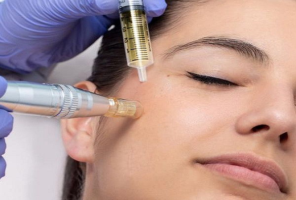 Plasma Rico en Plaquetas Full Face + Masaje Linfático Facial