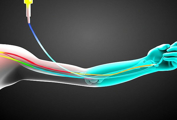 Sueroterapia Ortomolecular: Suero Intravenoso NeuroVital