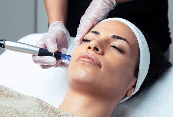 2x1 en Plasma Rico en Plaquetas con Dermapen o con Aguja