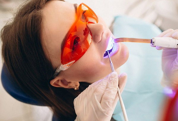 Limpieza Dental + Ozono Antibacterial