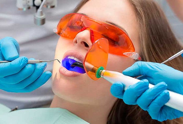 Limpieza Dental + Ozono Antibacterial