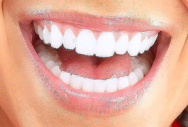 Revisión Dental con Limpieza ultrasónica y Radiografías