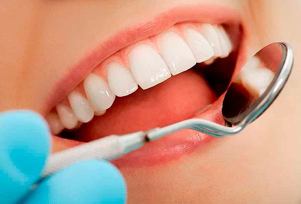 Limpieza Dental con Ultrasonido en Prodental Lab 