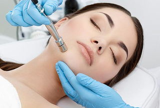 Tratamiento de puntos negros con Microdermoabrasión