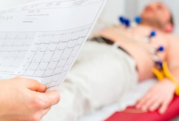 Check up de Medicina General con Electrocardiograma