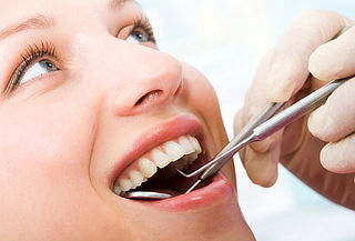 ¡Dientes Limpios y Sanos! Limpieza Dental Profunda