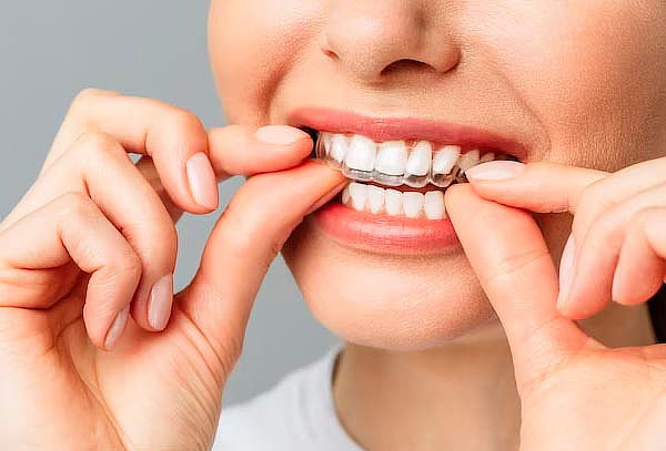 Consulta Dental + Odontograma +Eliminación Sarro + Regalo.