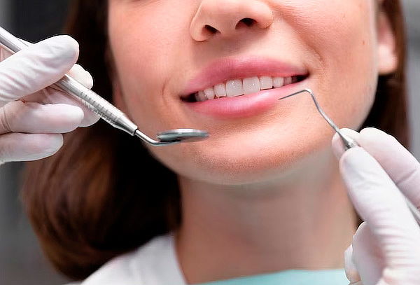 Carilla Dental + Evaluación Odontológica y más - Stardent