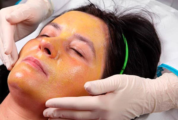 Rejuvenece con 1 Sesión de Yellow Peel en Rostro Completo