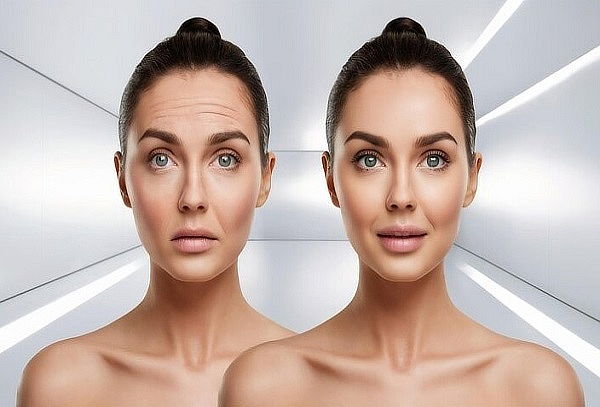 Toxina Botulínica + Retoque + Mascarilla hidratante