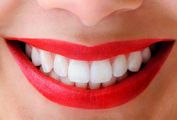 Limpieza Dental Profunda + Odontograma + Destartaje 4 Sedes