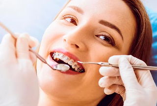 Paquete Completo de Brackets Metálicos + Limpieza + Regalo 